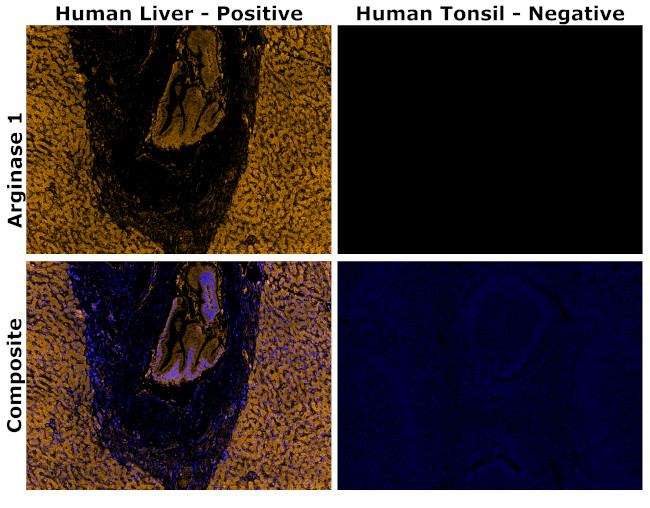 Arginase 1 Antibody in Immunohistochemistry (Paraffin) (IHC (P))