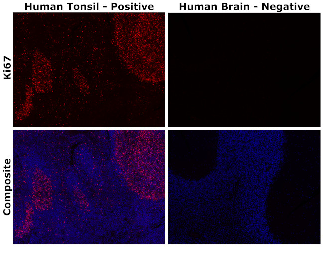 Ki-67 Antibody in Immunohistochemistry (Paraffin) (IHC (P))