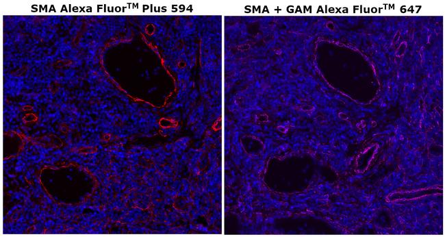 Alpha-Smooth Muscle Actin Antibody in Immunohistochemistry (Paraffin) (IHC (P))