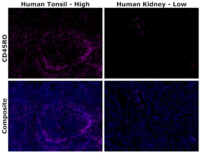 CD45RO Antibody in Immunohistochemistry (Paraffin) (IHC (P))