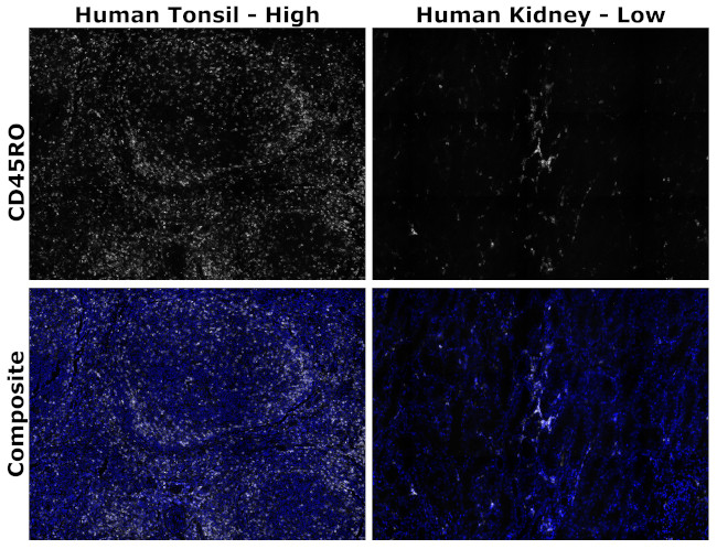 CD45RO Antibody in Immunohistochemistry (Paraffin) (IHC (P))