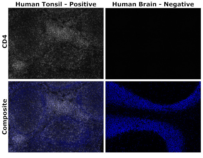 CD4 Antibody in Immunohistochemistry (Paraffin) (IHC (P))