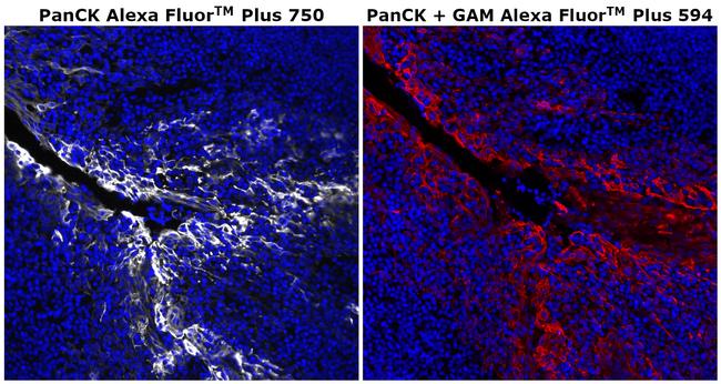 Pan Cytokeratin Antibody in Immunohistochemistry (Paraffin) (IHC (P))