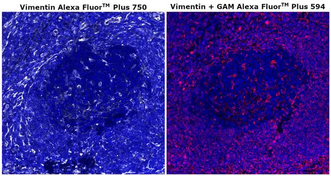 Vimentin Antibody in Immunohistochemistry (Paraffin) (IHC (P))