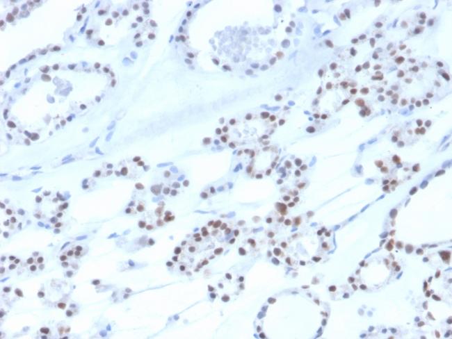 PAX8 (Renal Cell Marker) Antibody in Immunohistochemistry (Paraffin) (IHC (P))