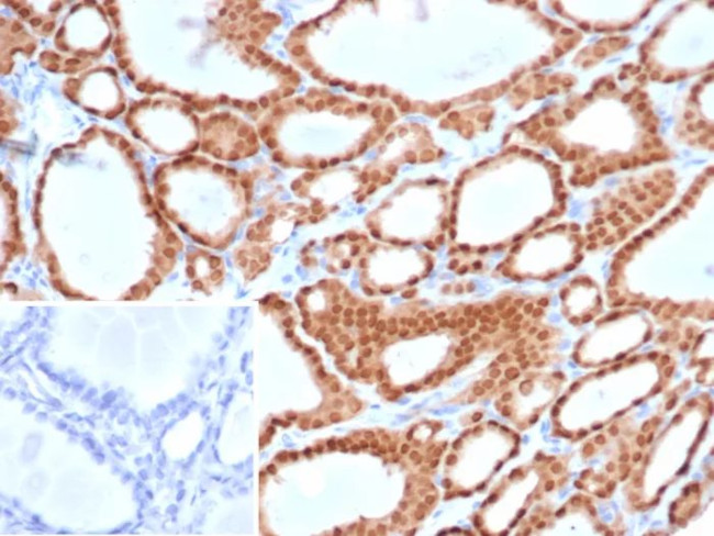 PAX8 (Renal Cell Marker) Antibody in Immunohistochemistry (Paraffin) (IHC (P))