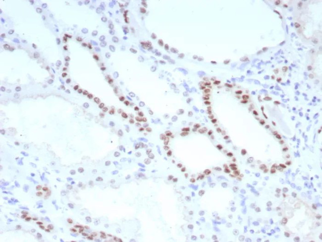 PAX8 (Renal Cell Marker) Antibody in Immunohistochemistry (Paraffin) (IHC (P))