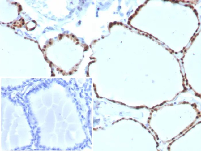 PAX8 (Renal Cell Marker) Antibody in Immunohistochemistry (Paraffin) (IHC (P))