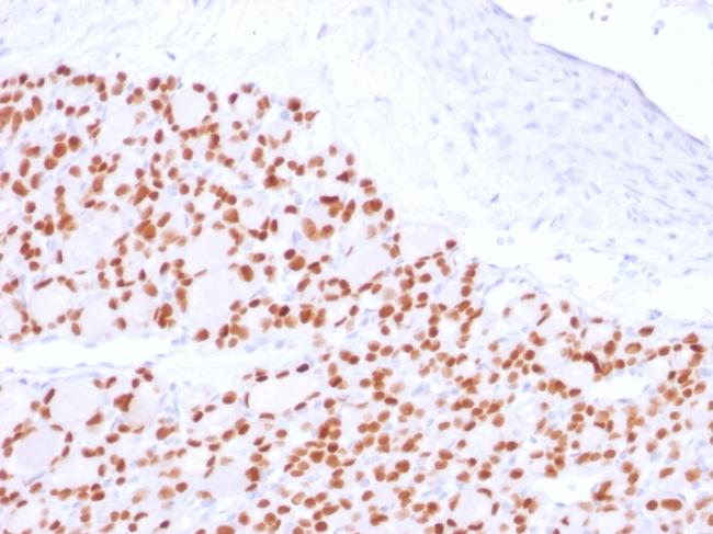 PAX8 Antibody in Immunohistochemistry (Paraffin) (IHC (P))