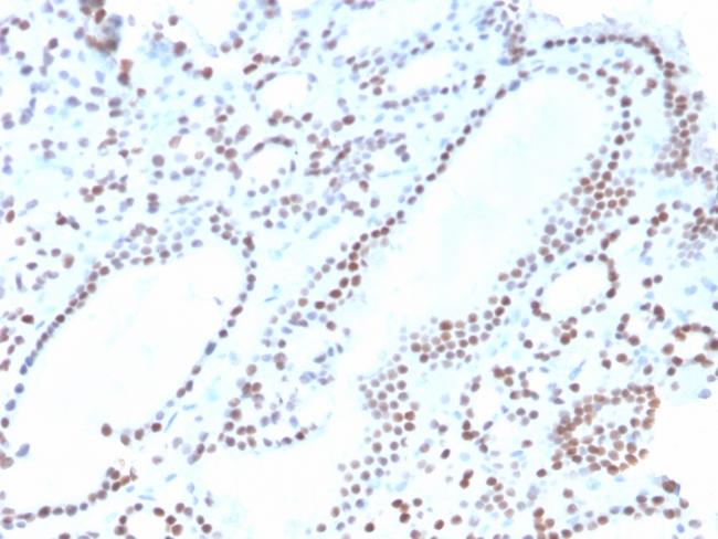 PAX8 (Renal Cell Marker) Antibody in Immunohistochemistry (Paraffin) (IHC (P))