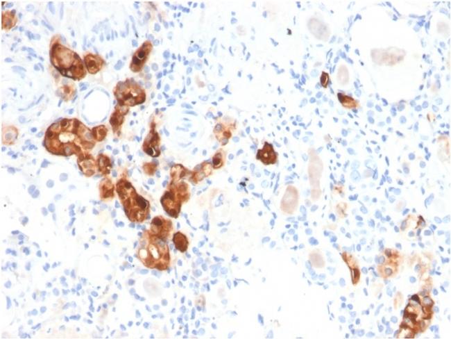 Calbindin 1 (CALB1) Antibody in Immunohistochemistry (Paraffin) (IHC (P))