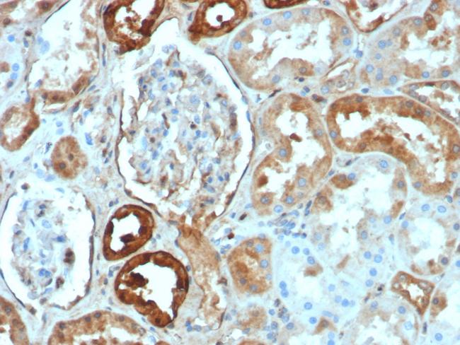 Calbindin 1 (CALB1) Antibody in Immunohistochemistry (Paraffin) (IHC (P))