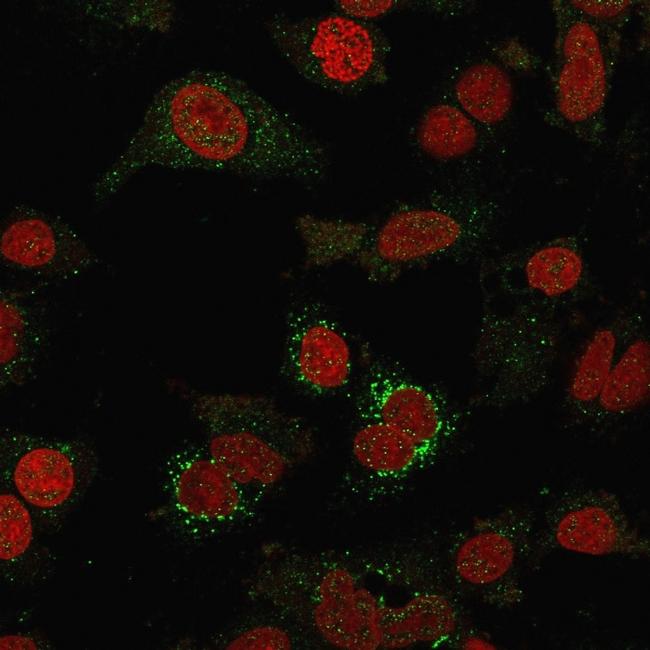 B7-H4 (Immuno-Inhibitory Protein) Antibody in Immunocytochemistry (ICC/IF)