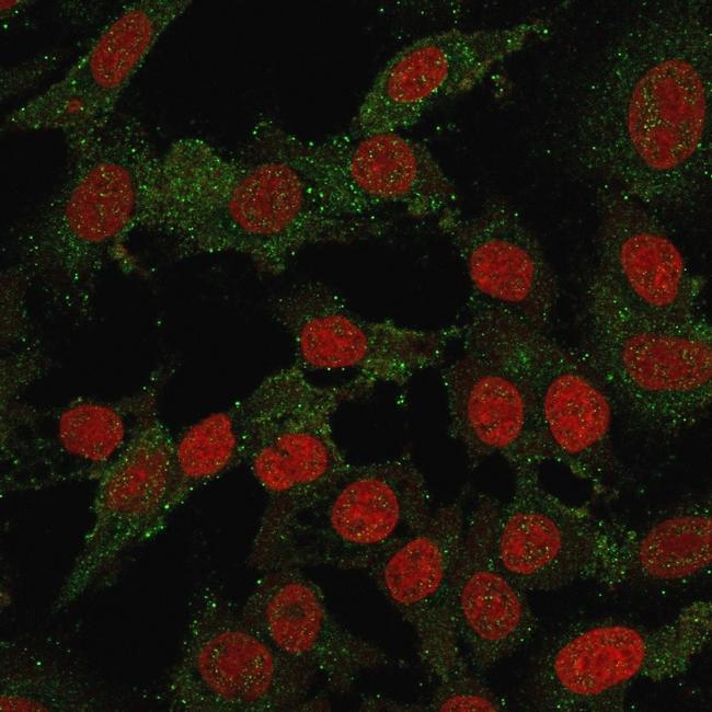 B7-H4 (Immuno-Inhibitory Protein) Antibody in Immunocytochemistry (ICC/IF)