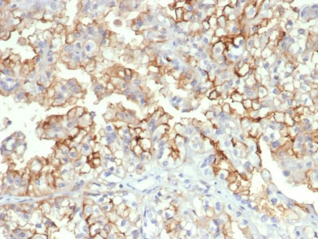 CD276/B7-H3 Antibody in Immunohistochemistry (Paraffin) (IHC (P))