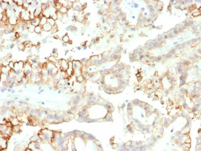 CD276/B7-H3 Antibody in Immunohistochemistry (Paraffin) (IHC (P))