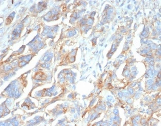 CD276/B7-H3 Antibody in Immunohistochemistry (Paraffin) (IHC (P))