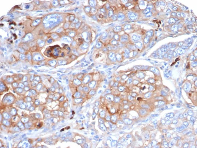 CD276/B7-H3 Antibody in Immunohistochemistry (Paraffin) (IHC (P))