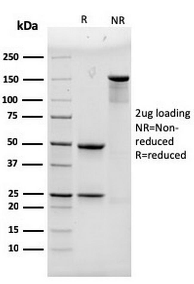 Alpha Actinin 4/ACTN4 Antibody in SDS-PAGE (SDS-PAGE)