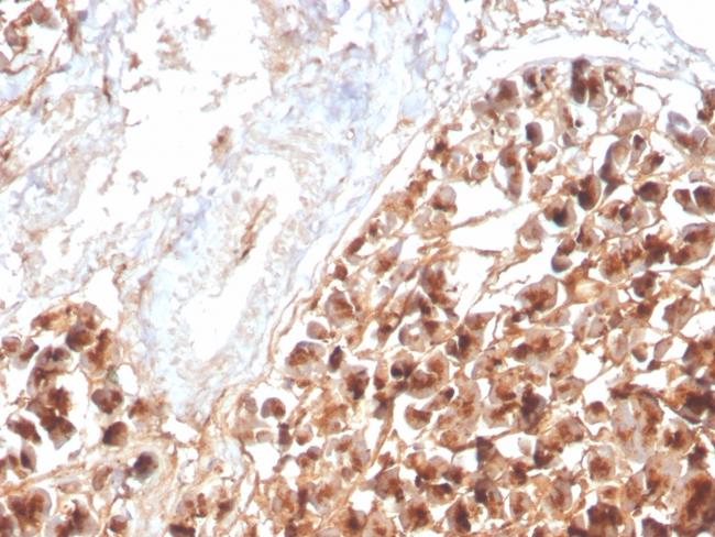 Eosinophil Peroxidase (EPX) Antibody in Immunohistochemistry (Paraffin) (IHC (P))