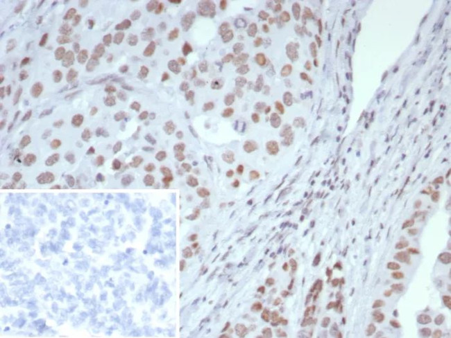 ARID1A/SMARCF1 Antibody in Immunohistochemistry (Paraffin) (IHC (P))