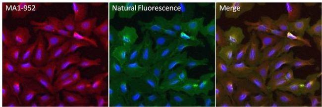 Mouse IgG (H+L) Secondary Antibody in Immunocytochemistry (ICC/IF)