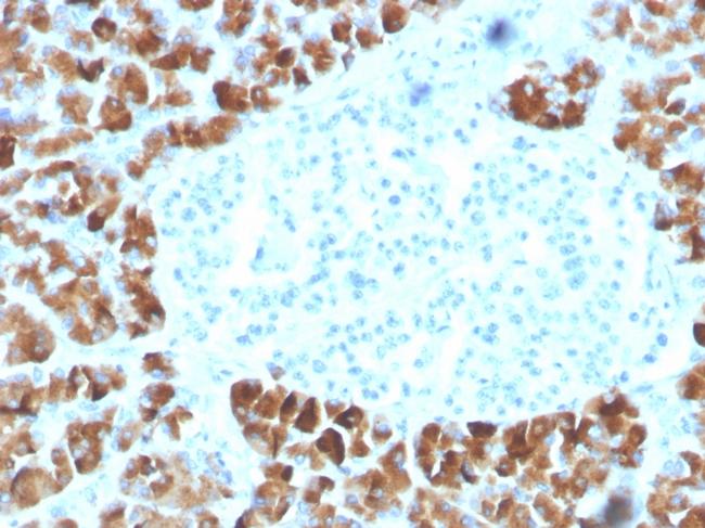 Insulinoma Associated 2/INSM2 Antibody in Immunohistochemistry (Paraffin) (IHC (P))