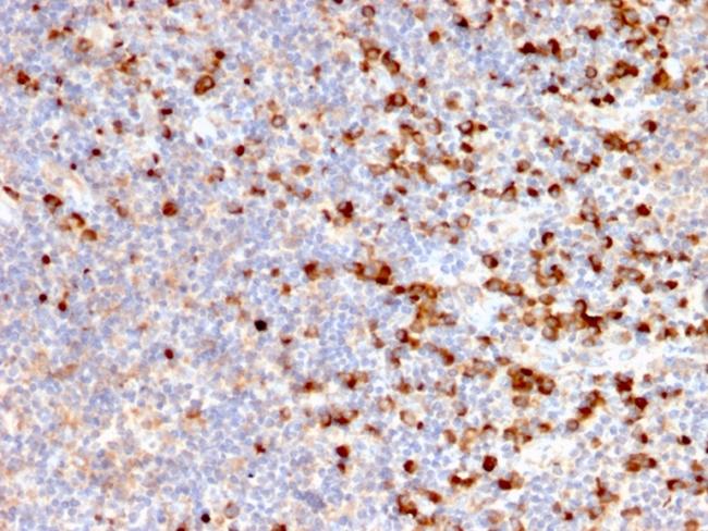 TIM3/HAVCR2/CD366 (Effector T-Cell Marker) Antibody in Immunohistochemistry (Paraffin) (IHC (P))