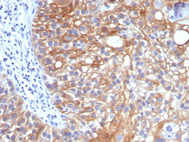 TIM3/HAVCR2/CD366 (Effector T-Cell Marker) Antibody in Immunohistochemistry (Paraffin) (IHC (P))