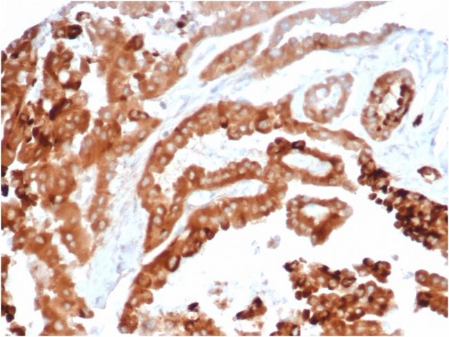 TIM3/HAVCR2/ CD366 (Effector T-Cell Marker) Antibody in Immunohistochemistry (Paraffin) (IHC (P))