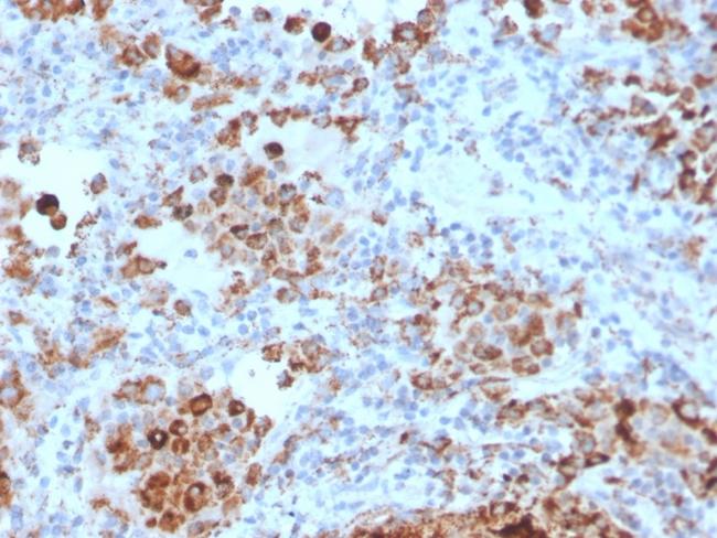 TIM3/HAVCR2/CD366 (Effector T-Cell Marker) Antibody in Immunohistochemistry (Paraffin) (IHC (P))