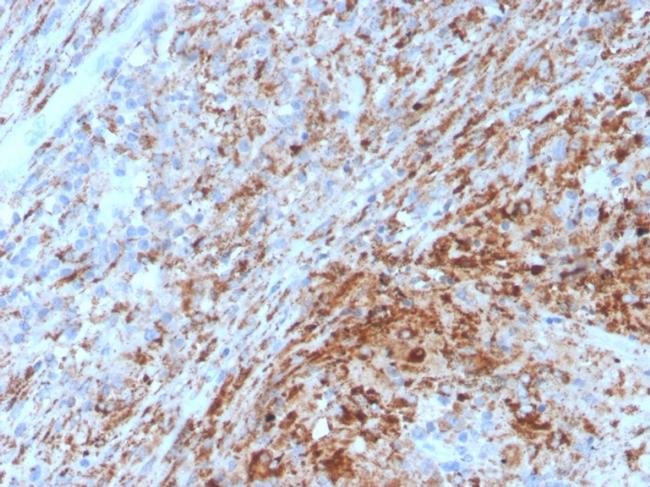 TIM3/HAVCR2/CD366 Antibody in Immunohistochemistry (Paraffin) (IHC (P))