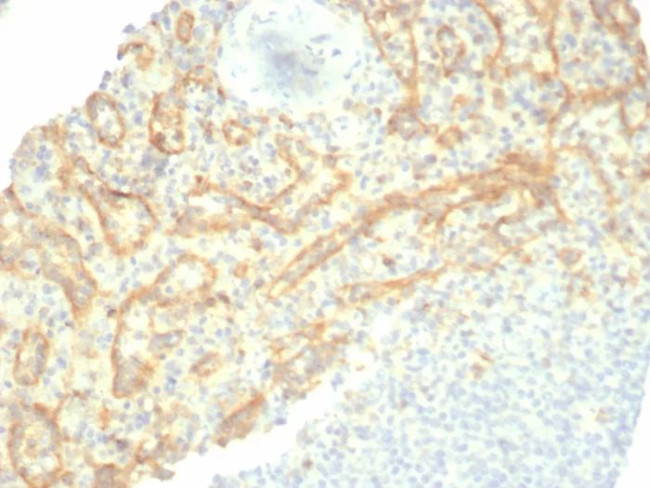 TIM3/HAVCR2/CD366 (Effector T-Cell Marker) Antibody in Immunohistochemistry (Paraffin) (IHC (P))