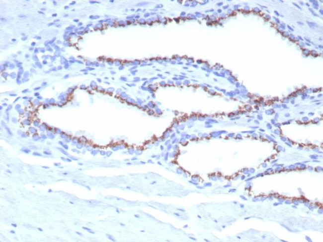 Prostein (p501S)/Solute Carrier Family 45 Member 3 (SLC45A3) Antibody in Immunohistochemistry (Paraffin) (IHC (P))