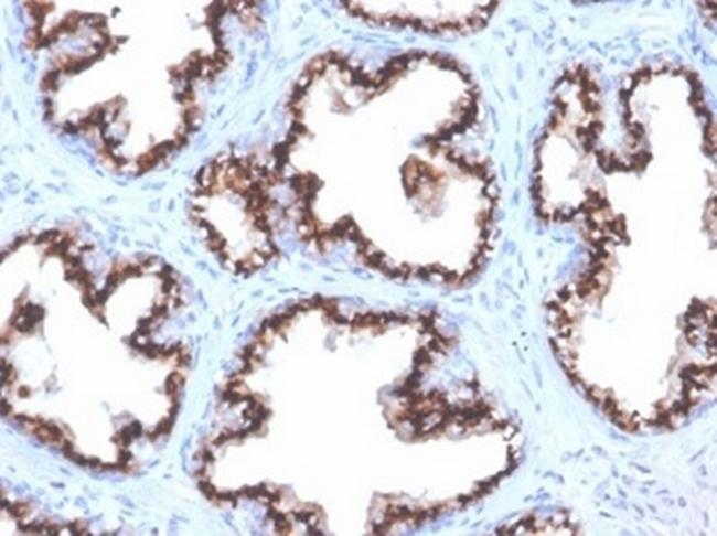 Prostein (p501S)/Solute Carrier Family 45 Member 3 (SLC45A3) Antibody in Immunohistochemistry (Paraffin) (IHC (P))