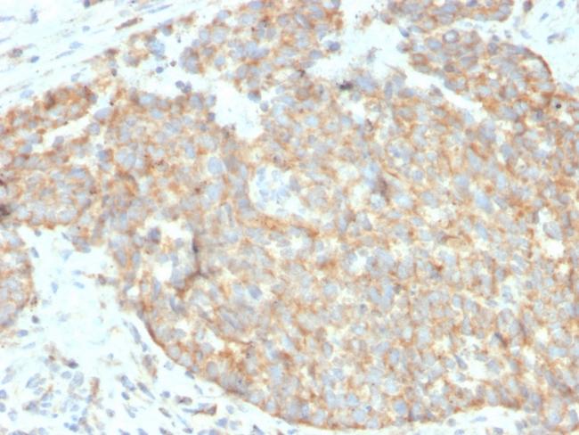 CD262/DR5 Antibody in Immunohistochemistry (Paraffin) (IHC (P))