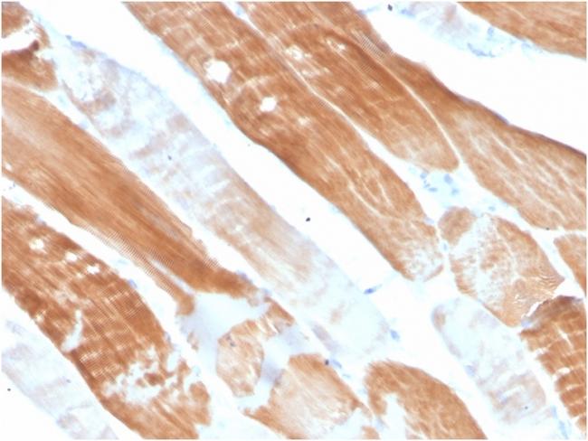 Sarcomeric Actinin Alpha 2/ACTN2 Antibody in Immunohistochemistry (Paraffin) (IHC (P))