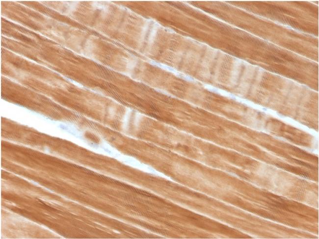 Sarcomeric Actinin Alpha 2/ACTN2 Antibody in Immunohistochemistry (Paraffin) (IHC (P))