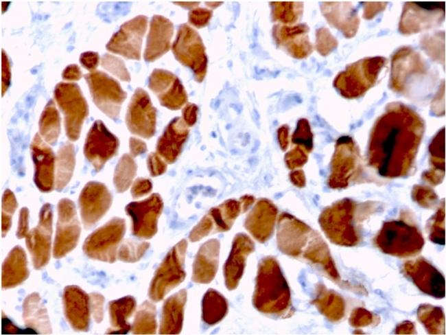 Sarcomeric Actinin Alpha 2/ACTN2 Antibody in Immunohistochemistry (Paraffin) (IHC (P))