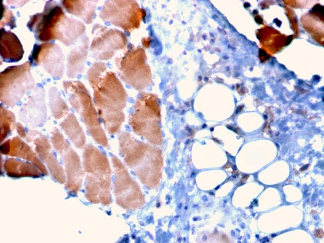 Sarcomeric Actinin Alpha 2/ACTN2 Antibody in Immunohistochemistry (Paraffin) (IHC (P))