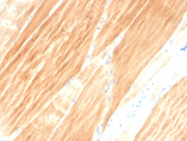 Sarcomeric Actinin Alpha 2/ACTN2 Antibody in Immunohistochemistry (Paraffin) (IHC (P))