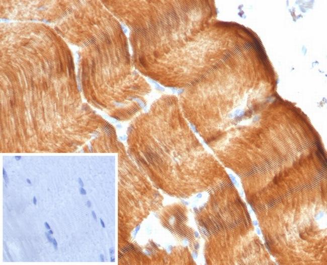 Sarcomeric Actinin Alpha 2/ACTN2 Antibody in Immunohistochemistry (Paraffin) (IHC (P))