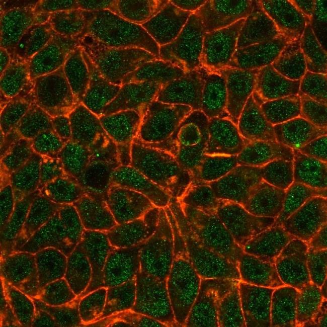 TRIM24/TIF1 alpha Antibody in Immunocytochemistry (ICC/IF)