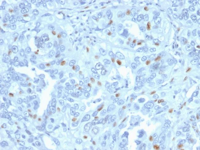 Cyclin A2 (S- and G2-phase Cyclin) Antibody in Immunohistochemistry (Paraffin) (IHC (P))