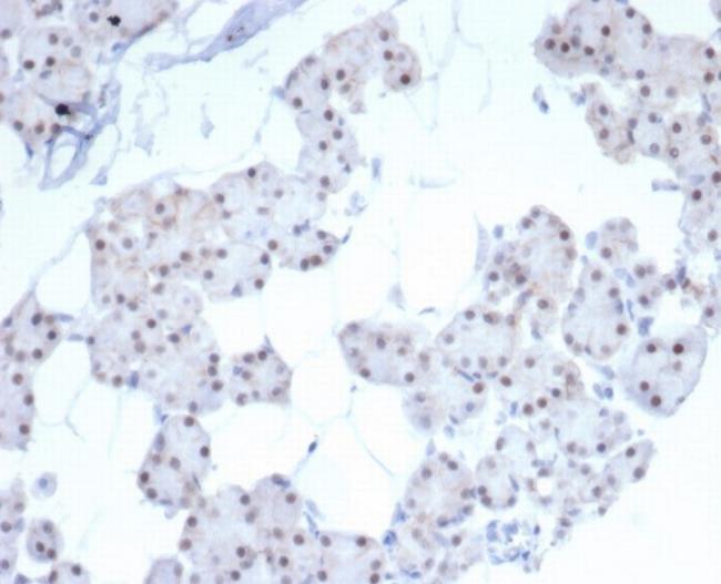 PHOX2B Antibody in Immunohistochemistry (Paraffin) (IHC (P))