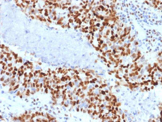 Cyclin E (G1/S-Phase Cyclin) Antibody in Immunohistochemistry (Paraffin) (IHC (P))