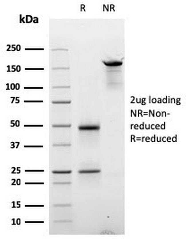 Cyclin E (G1/S-Phase Cyclin) Antibody in SDS-PAGE (SDS-PAGE)