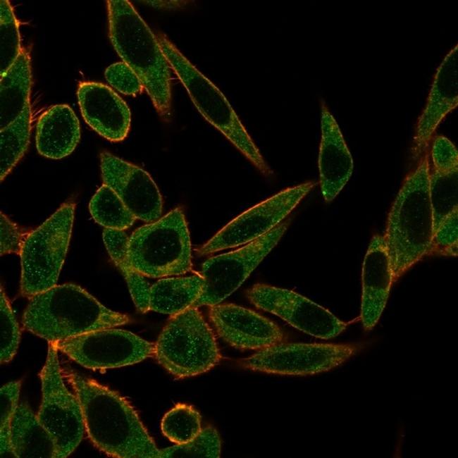 ZNF622/ZPR9 (Transcription Factor) Antibody in Immunocytochemistry (ICC/IF)