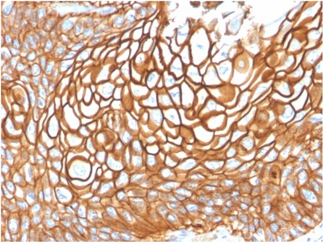 CD9 (TSPAN29) (Motility-Related Protein-1) Antibody in Immunohistochemistry (Paraffin) (IHC (P))