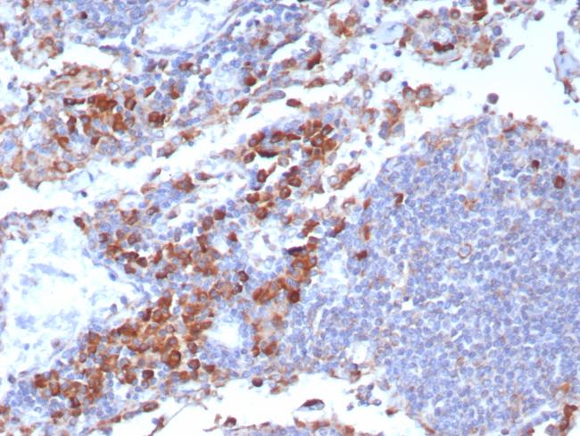 CD9 (TSPAN29) (Motility-Related Protein-1) Antibody in Immunohistochemistry (Paraffin) (IHC (P))